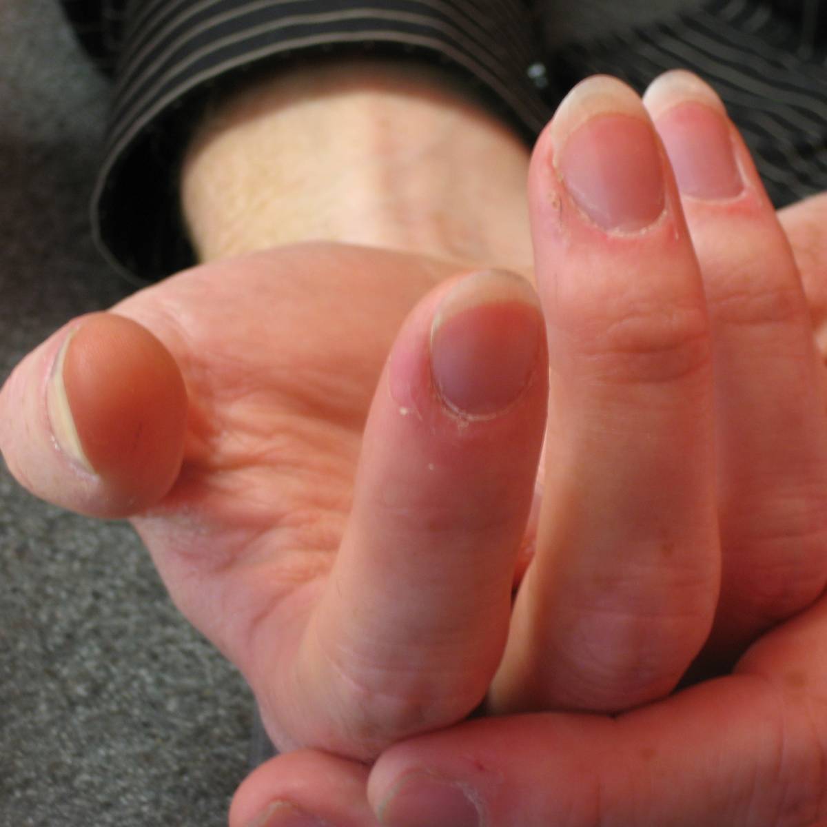 The right hand fingernails of a guitar player showing fairly long fingernails shaped exactly how it's shown in this article
